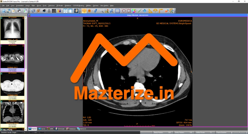 Sante DICOM Viewer Pro Free Download