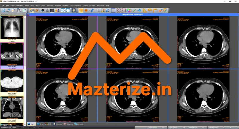 Sante DICOM Viewer Pro Free Download