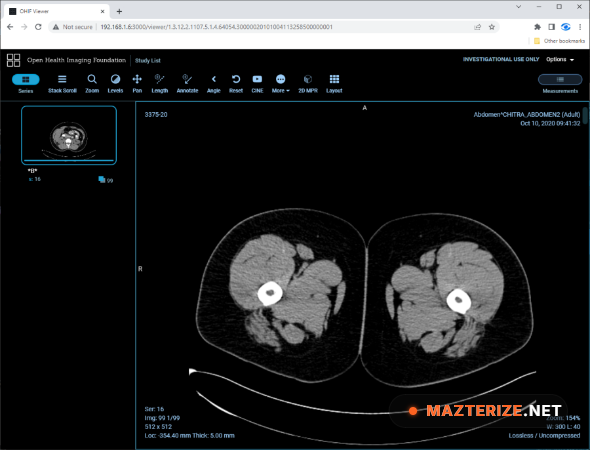 Sante PACS Server PG 4.5 Full Version Download Sante PACS Server PG 4.5 Full Version Free Download
